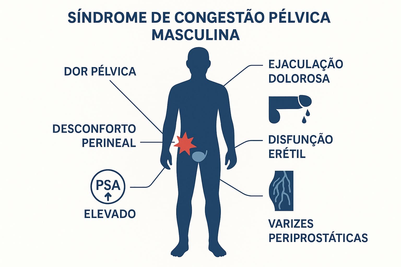 Representação visual dos principais sintomas da Síndrome de Congestão Pélvica Masculina